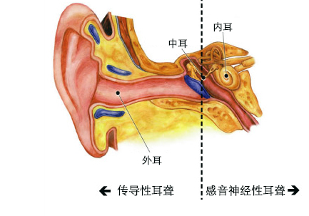 了解孩子的聽(tīng)力